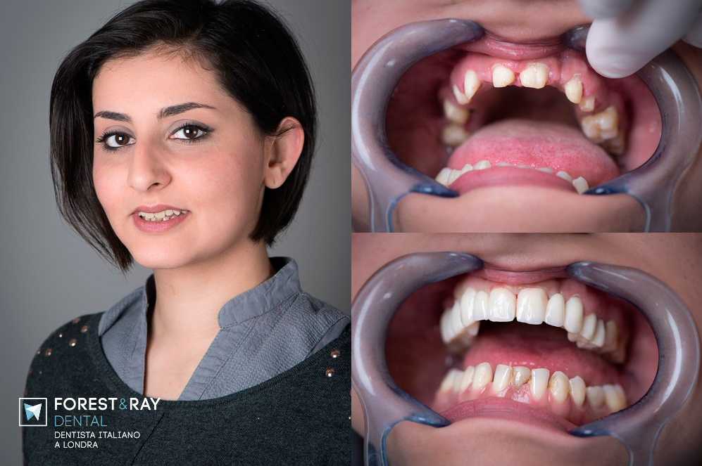 Simona dentista italiana a Londra by Forest&Rey